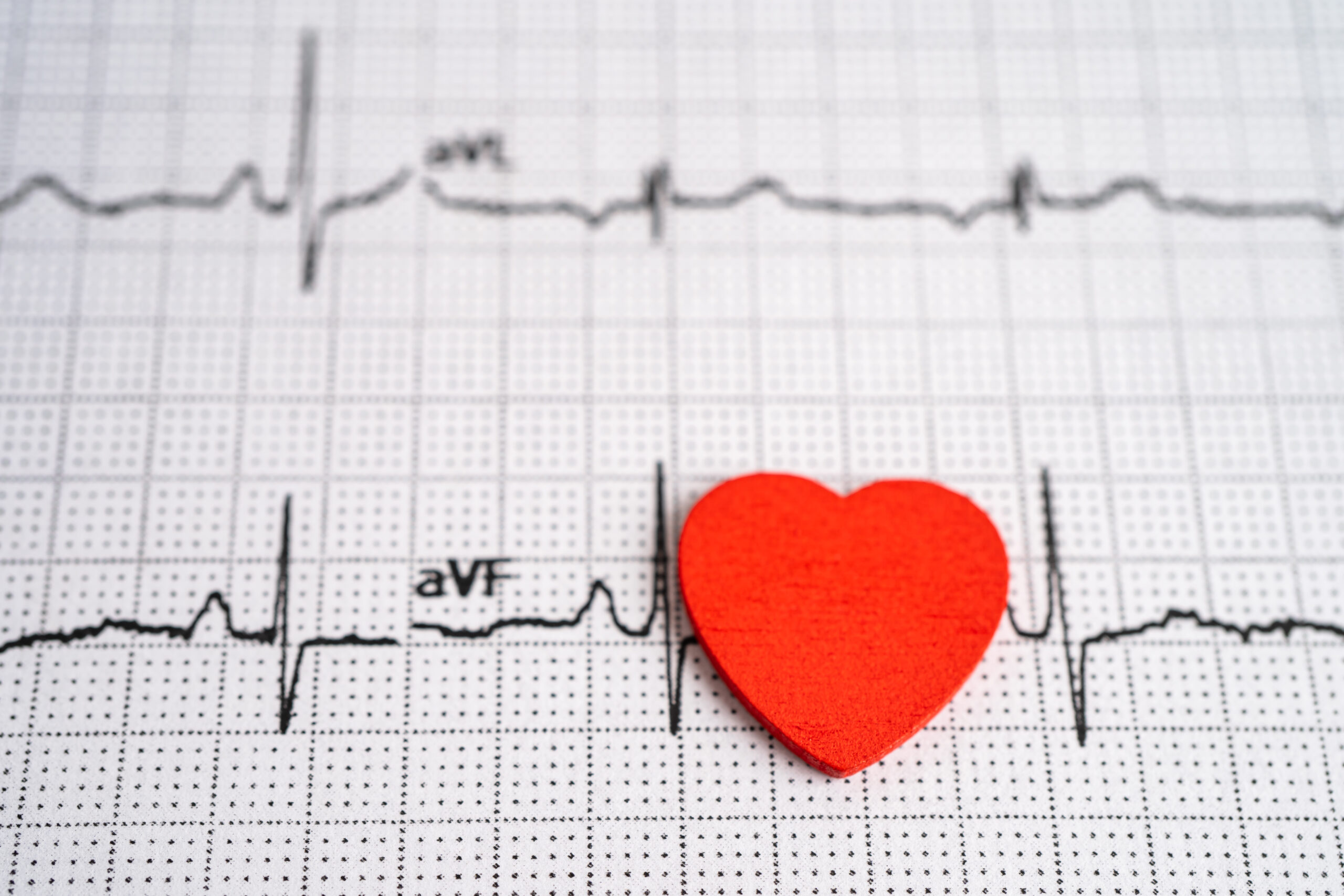 Al momento stai visualizzando Palpitazioni, Tachicardia e Cardiopalmo: quando “Sentiamo” il Cuore battere!