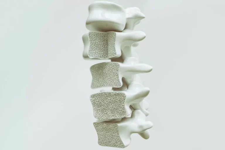 Scopri di pi&ugrave; sull'articolo Osteoporosi Vertebrale